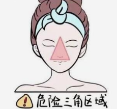 臉部的三角區(qū)域在哪里？為什么三角區(qū)域容易長痘？