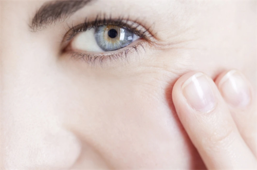 细纹、黑眼圈、眼袋的成因，预防眼部衰老